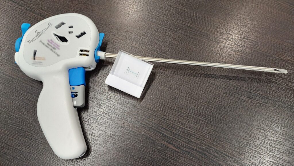 55歲男子攝護腺肥大 攝護腺拉開手術 保住「性」福 55歲男子攝護腺肥大 攝護腺拉開手術 保住「性」福