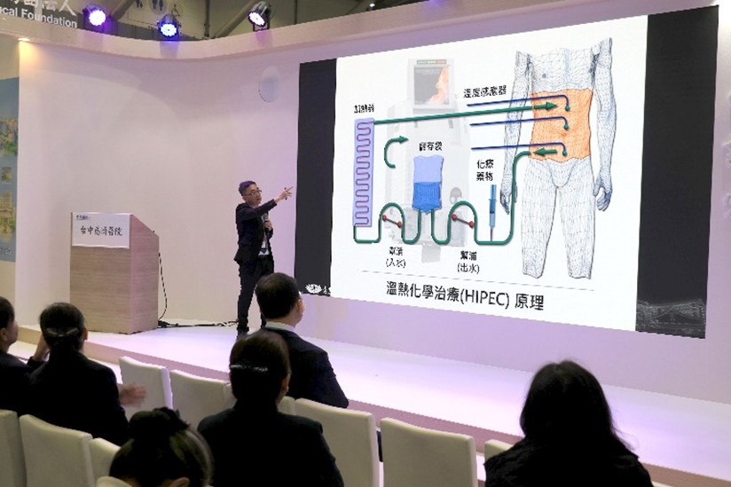 身心有溫度抗癌 高階熱治療強化腹膜腫瘤療效 身心有溫度抗癌 高階熱治療強化腹膜腫瘤療效