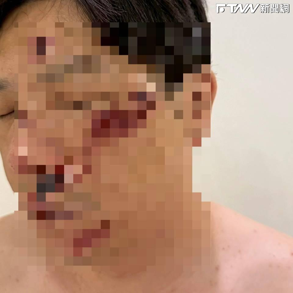 拒載糾紛釀衝突？美而快董事還原爭執始末