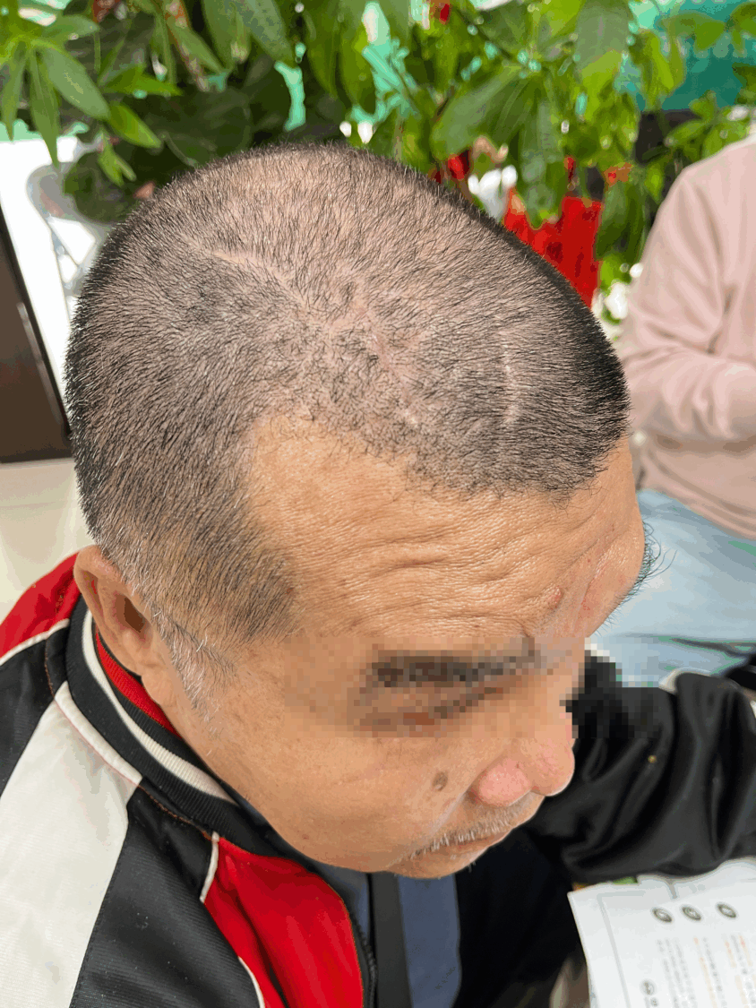 工人遇職災失明控公司倉促和解　工程公司：該員未繫安全帶、補償均備妥