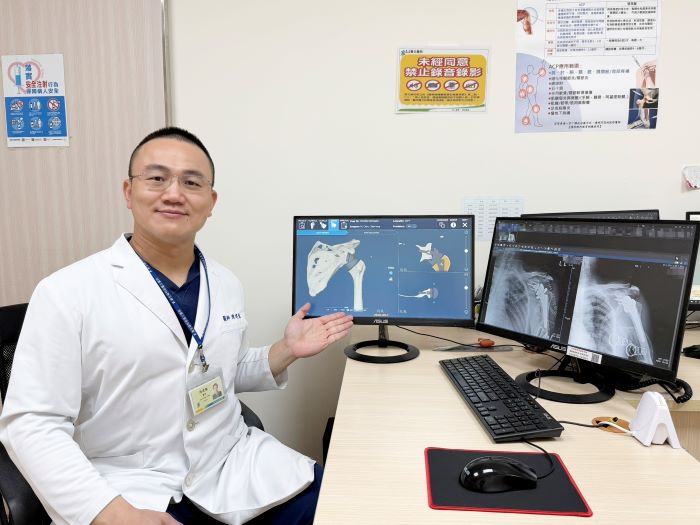 術前3D模擬助攻 臺北醫院肩關節置換手術更精準安全 術前3D模擬助攻 臺北醫院肩關節置換手術更精準安全