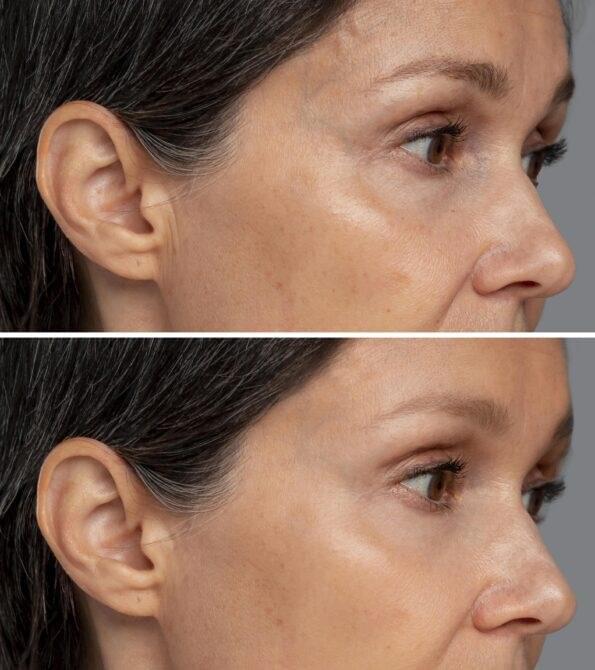 The Benefits of LED Red 633nm and Near-Infrared 830nm Light Therapy